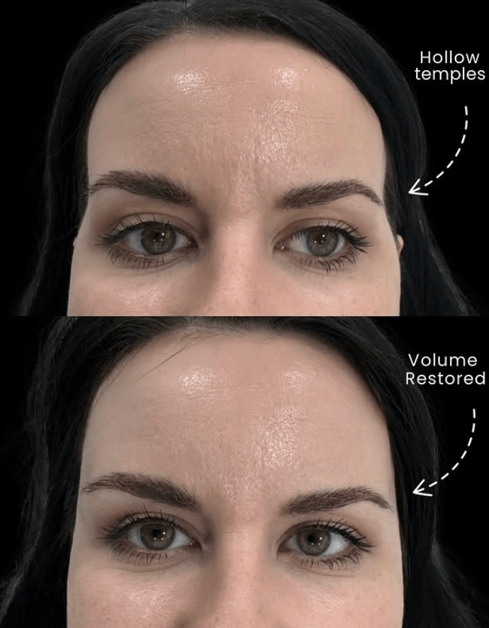 Facial Balancing — 1